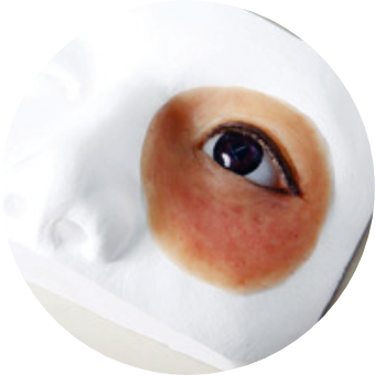 エピテーゼ