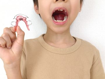 歯並びが悪くなる原因とは…？