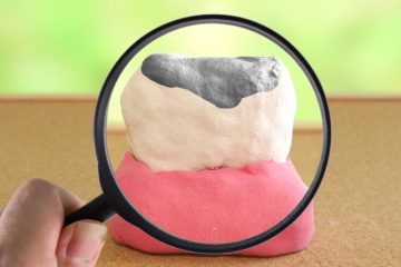 歯科技工士の次のステップ