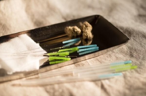 鍼やお灸