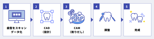 CAD-CAMで歯が完成するまでの流れ