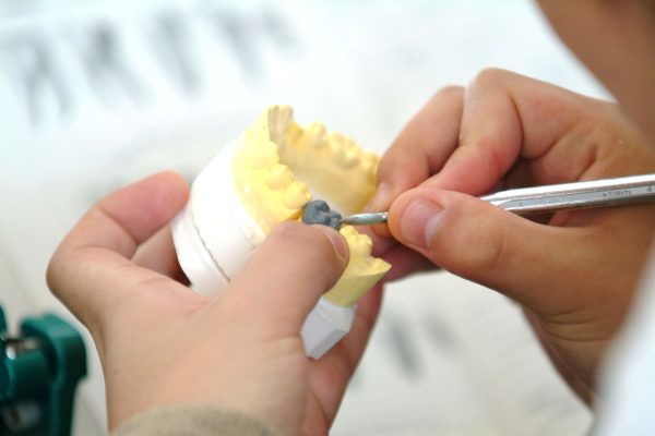 細かな作業が求められます。