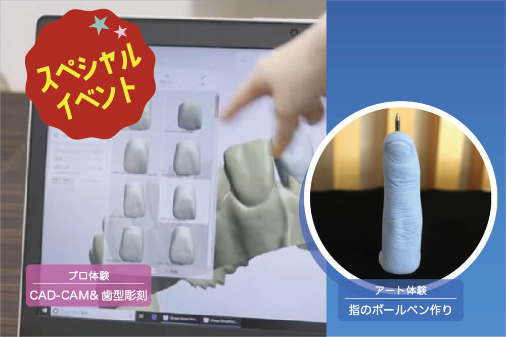 【プロ】CAD-CAM&歯型彫刻【アート】指ボールペン