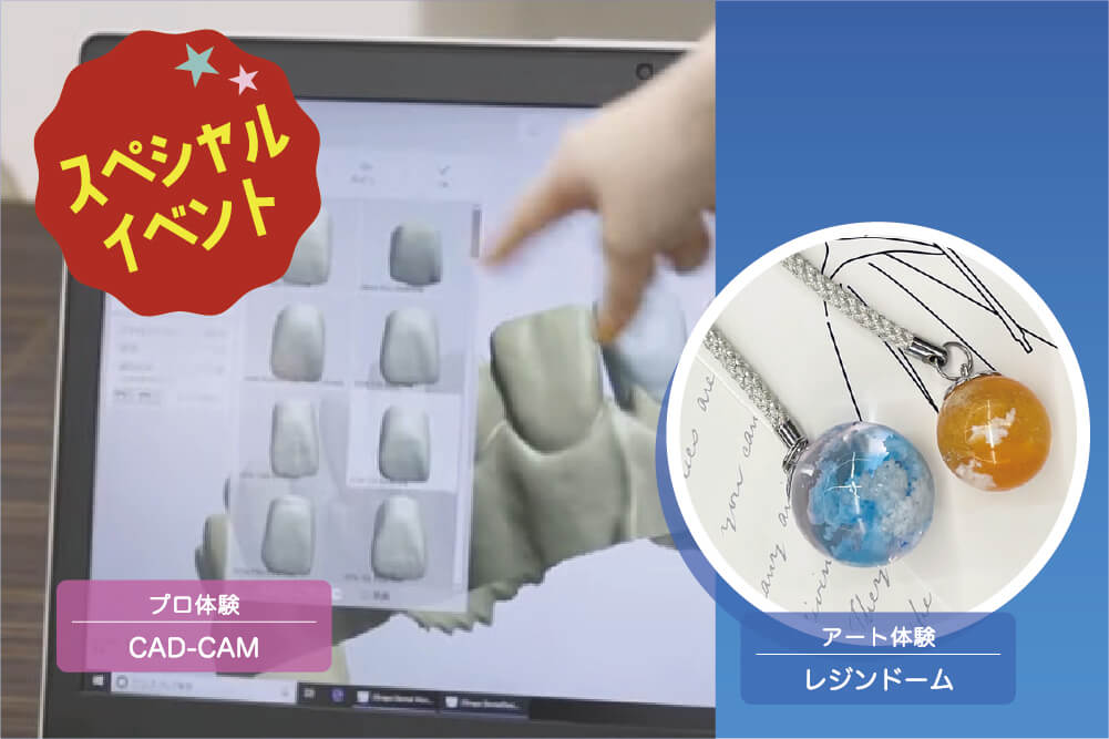【プロ】CAD-CAM 【アート】レジンドーム