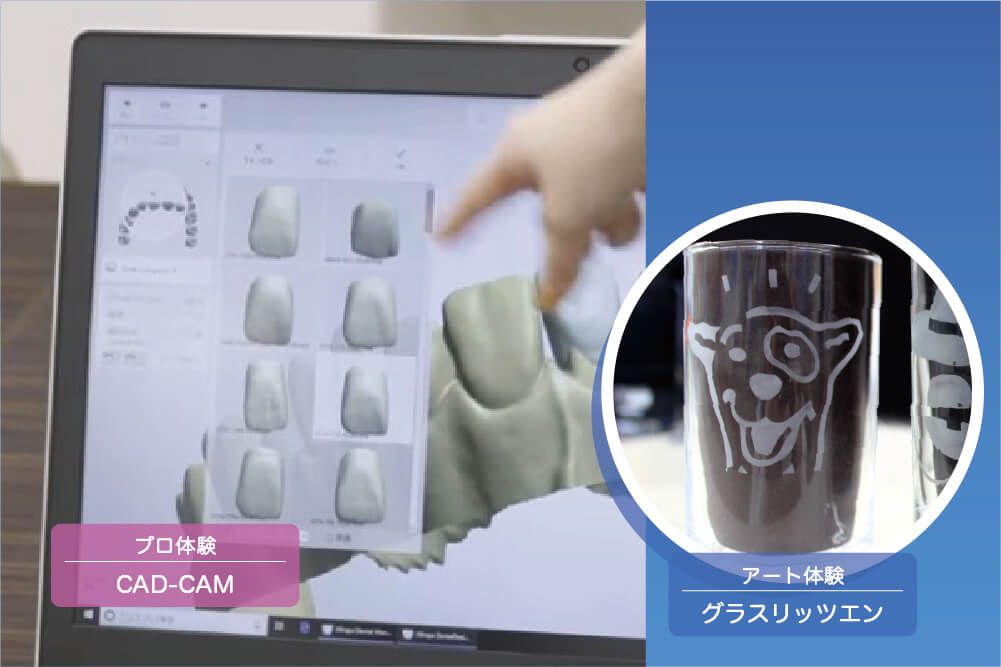 【プロ】CAD-CAM 【アート】グラスリッツェン